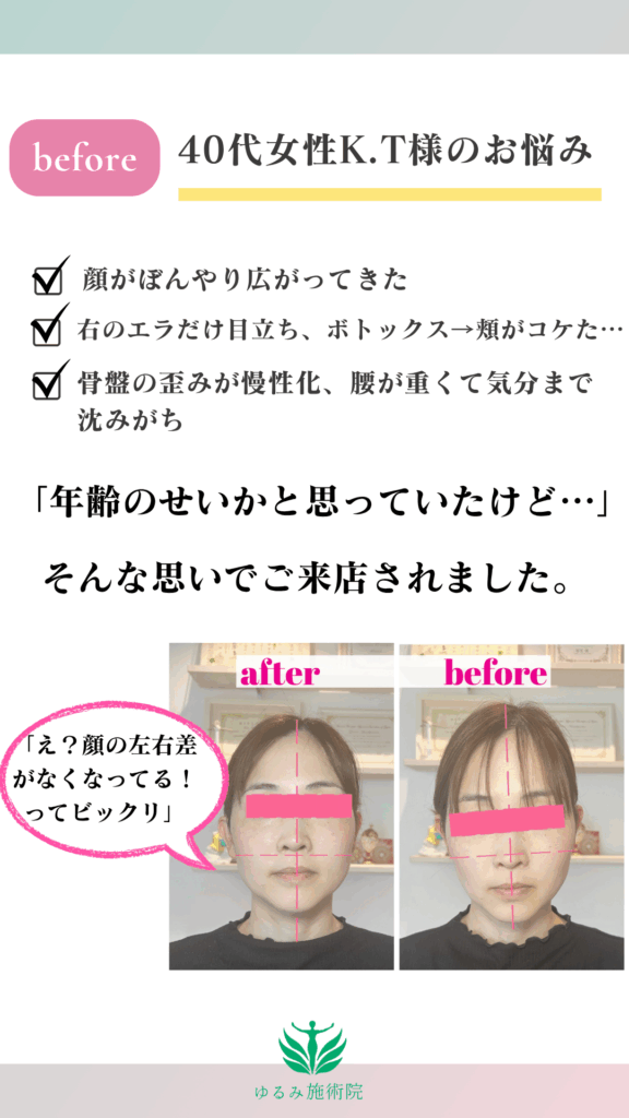 「年齢のせいかと思っていたけど…」 そんな思いでご来店されました。