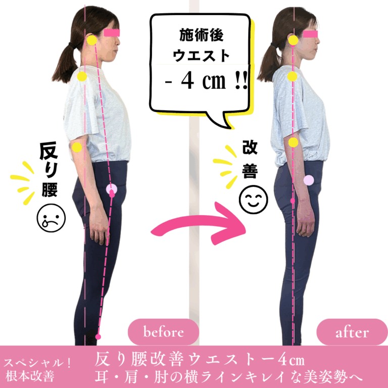 【愛媛・松山】小顔矯正と美容整体でむくみ・たるみ改善｜ゆるみ施術院